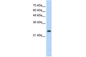 WB Suggested Anti-HOXB7 Antibody Titration: 1. (HOXB7 antibody  (C-Term))