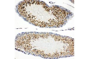 Anti-TIM 1 antibody, IHC(P) IHC(P): Rat Testis Tissue (HAVCR1 antibody  (C-Term))