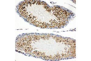 Anti-TIM 1 antibody, IHC(P) IHC(P): Rat Testis Tissue