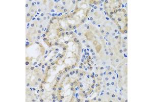 Immunohistochemistry of paraffin-embedded mouse kidney using CETN3 antibody.
