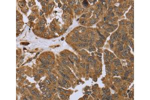 Immunohistochemistry (IHC) image for anti-Inhibitor of KB Kinase beta Interacting Protein (IKbIP) antibody (ABIN2423647) (IKbIP antibody)