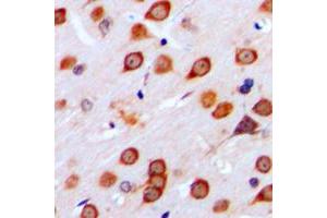 Immunohistochemical analysis of mGLUR4 staining in human brain formalin fixed paraffin embedded tissue section. (Metabotropic Glutamate Receptor 4 antibody  (C-Term))