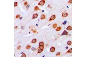 Immunohistochemical analysis of mGLUR4 staining in human brain formalin fixed paraffin embedded tissue section.