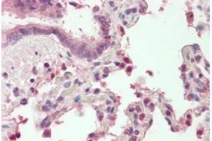 Human, Lung: Formalin-Fixed Paraffin-Embedded (FFPE) (MZF1 antibody  (N-Term))