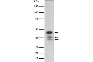 Western Blotting (WB) image for anti-Caspase 9, Apoptosis-Related Cysteine Peptidase (CASP9) (cleaved) antibody (ABIN7606900)