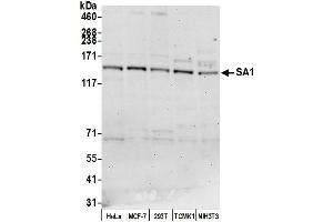 Western Blotting (WB) image for anti-Stromal Antigen 1 (STAG1) (AA 25-75) antibody (ABIN7453337)