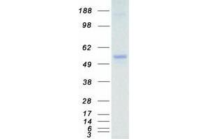 Western Blotting (WB) image for MAP Kinase Interacting serine/threonine Kinase 1 (MKNK1) (Transcript Variant 1) protein (Myc-DYKDDDDK Tag) (ABIN2726083)