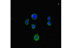 Immunofluorescent analysis of MCF-7 cells using ABIN7158049 at dilution of 1:100 and Alexa Fluor 488-congugated AffiniPure Goat Anti-Rabbit IgG(H+L) (LRCH1 antibody  (AA 1-105))