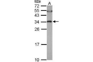 Western Blotting (WB) image for anti-Eukaryotic Translation Elongation Factor 1 beta 2 (EEF1B2) antibody (ABIN2856398)