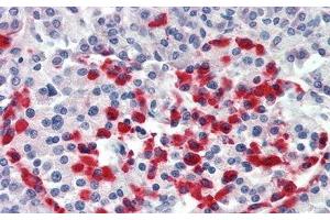 Detection of ITGb6 in Human Pancreas Tissue using Polyclonal Antibody to Integrin Beta 6 (ITGb6) (ITGB6 antibody  (AA 131-371))