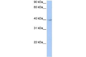 WB Suggested Anti-ZBTB6 Antibody Titration:  0. (ZBTB6 antibody  (Middle Region))