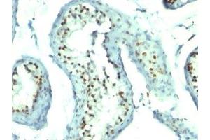 Immunohistochemistry (IHC) image for anti-Nucleolin (NCL) antibody (ABIN3025715)