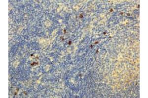 Immunohistochemical staining (Formalin-fixed paraffin-embedded sections) of human lymphoid tissue with Human IgG4 monoclonal antibody, clone RM120  under 5 ug/mL working concentration.