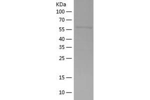 Western Blotting (WB) image for Protein Phosphatase 1, Regulatory Subunit 3A (PPP1R3A) (AA 1-323) protein (His-IF2DI Tag) (ABIN7281902) (PPP1R3A Protein (AA 1-323) (His-IF2DI Tag))