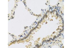 Immunohistochemistry of paraffin-embedded Rat lung using RSPO1 Polyclonal Antibody at dilution of 1:100 (40x lens). (RSPO1 antibody)