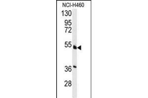 Western blot analysis of anti-HNF4A Antibody  (ABIN389268 and ABIN2839401) in NCI- cell line lysates (35 μg/lane). (HNF4A antibody  (AA 118-146))