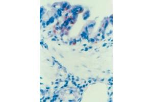 Immunohistochemical staining of Parainfluenza Typ 3 (PIV-3) in Lung epithelial cells (Guinea pig) (Parainfluenza Virus Type 3 antibody)