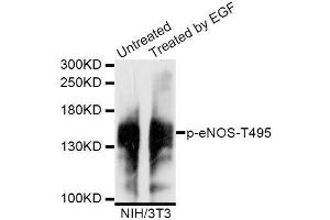 Western blot analysis of extracts of untreated and EGF-treated NIH/3T3 cells, using Phospho-eNOS-T495 antibody (ABIN5995598) at 1/1000 dilution. (ENOS antibody  (pTyr495))