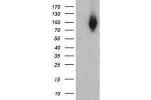 HEK293T cells were transfected with the pCMV6-ENTRY control (Left lane) or pCMV6-ENTRY C1S (Right lane) cDNA for 48 hrs and lysed. (C1S antibody)