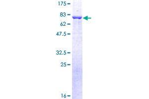 Arrestin 3 Protein (AA 1-409) (GST tag)