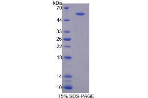 SDS-PAGE analysis of Rat RGS6 Protein. (RGS6 Protein)
