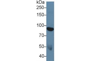 Detection of DDR1 in Human Serum using Polyclonal Antibody to Discoidin Domain Receptor Family, Member 1 (DDR1) (DDR1 antibody  (AA 568-829))