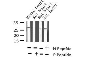 Western blot analysis of Phospho-TNNI3 (Thr142) expression in various lysates (TNNI3 antibody  (pThr143))