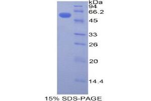 SDS-PAGE (SDS) image for Plastin 3 (PLS3) (AA 379-630) protein (His tag,GST tag) (ABIN2123478)
