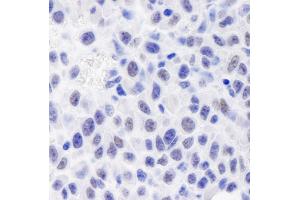 anti-General Transcription Factor III (GTF2I) (C-Term) antibody