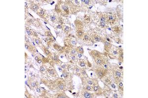 Immunohistochemistry of paraffin-embedded human liver injury using RPS10 antibody at dilution of 1:100 (x40 lens).