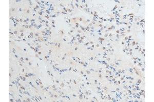 Immunohistochemistry (IHC) image for anti-Checkpoint Kinase 2 (CHEK2) (pThr387) antibody (ABIN6256554)