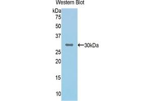 Western blot analysis of the recombinant protein. (Complement Factor I antibody  (AA 340-583))