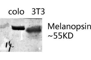 Western Blot (WB) analysis of specific lysis using Melanopsin Polyclonal Antibody. (OPN4 antibody  (C-Term))