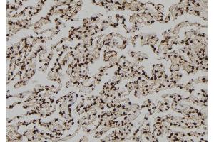 ABIN6273111 at 1/100 staining Human lung tissue by IHC-P. (DMAP1 antibody  (Internal Region))