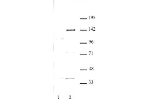 KDM4C antibody (pAb) tested by Western blot. (KDM4C antibody)
