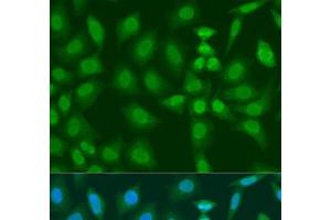 Immunofluorescence analysis of U2OS cells using PHF21B Polyclonal Antibody at dilution of 1:100. (PHF21B antibody)
