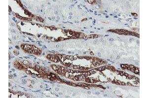 Image no. 1 for anti-phosphofructokinase, Platelet (PFKP) antibody (ABIN1500163) (PFKP antibody)