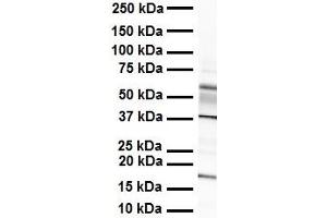 WB Suggested Anti-ZYX antibody Titration: 1 ug/mL Sample Type: Human heart (ZYX antibody  (Middle Region))
