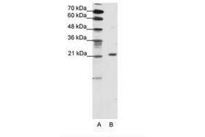 Image no. 1 for anti-Chromobox Homolog 1 (CBX1) (AA 61-110) antibody (ABIN202048) (CBX1 antibody  (AA 61-110))