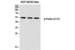 Western Blot (WB) analysis of 293T AD293 HeLa using p-Parkin (S131) antibody. (Parkin antibody  (pSer131))
