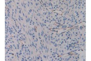Used in DAB staining on fromalin fixed paraffin- embedded liver tissue (Integrin beta 3 antibody  (AA 134-376))