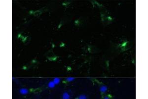 Immunofluorescence analysis of NIH-3T3 cells using ENO1 Polyclonal Antibody at dilution of 1:100. (ENO1 antibody)