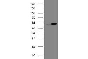 Image no. 1 for anti-Epoxide Hydrolase 1, Microsomal (Xenobiotic) (EPHX1) (AA 21-230) antibody (ABIN1491195)