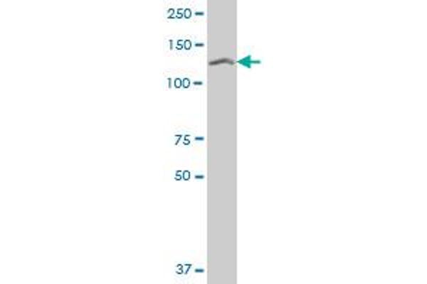 SETDB1 antibody  (AA 2-100)