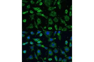 Immunofluorescence analysis of L-929 cells using SPARC Polyclonal Antibody (ABIN7270183) at dilution of 1:100 (40x lens). (SPARC antibody  (AA 18-303))