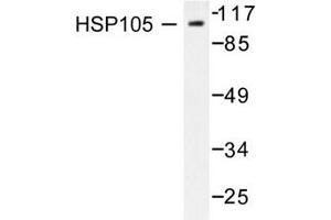 Image no. 2 for anti-Heat Shock 105kDa/110kDa Protein 1 (HSPH1) antibody (ABIN265469) (HSPH1 antibody)