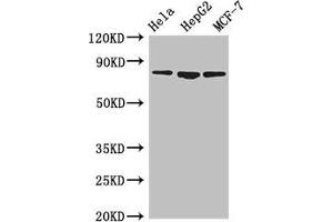 Western Blot Positive WB detected in: Hela whole cell lysate, HepG2 whole cell lysate, MCF-7 whole cell lysate All lanes: IMMT antibody at 3.