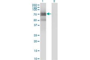 Western Blot analysis of BMX expression in transfected 293T cell line by BMX monoclonal antibody (M01), clone 3G3. (BMX antibody  (AA 150-280))