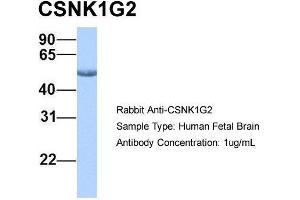 Host: Rabbit  Target Name: CSNK1G2  Sample Tissue: Human Fetal Brain  Antibody Dilution: 1. (Casein Kinase 1 gamma 2 antibody  (Middle Region))