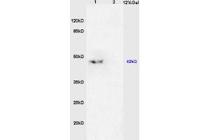 L1 mouse brain lysates, L2 mouse kidney lysates probed with Anti- TGF beta 2 Propeptide Polyclonal Antibody, Unconjugated (ABIN724880) at 1:200 in 4 °C. (TGF beta 2 Propeptide (AA 154-197) antibody)